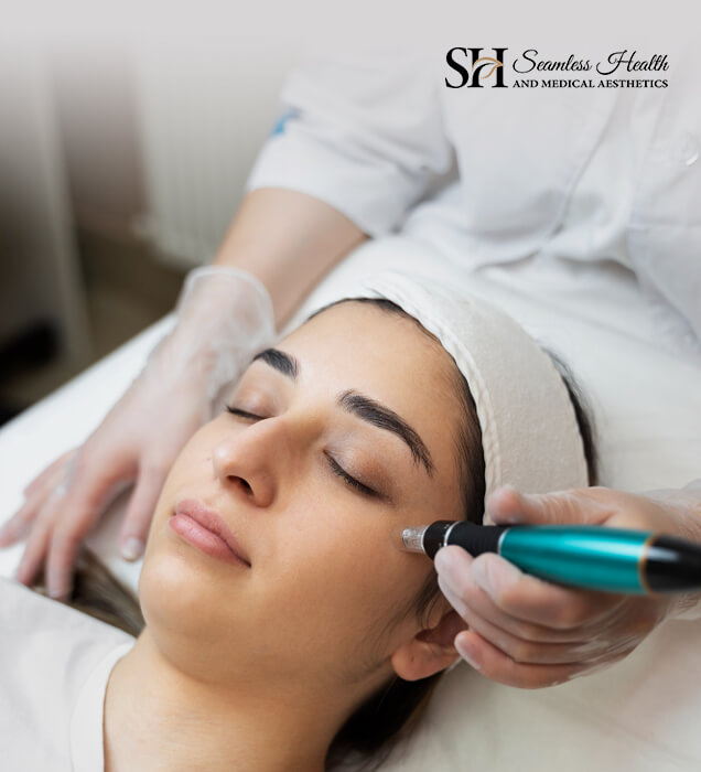 Microneedling pen being used on a patient's forehead