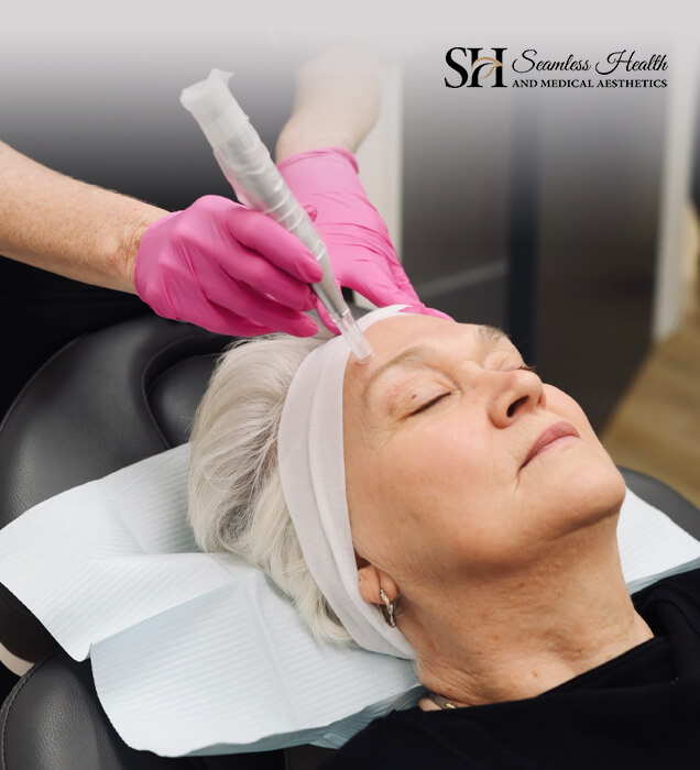 Microneedling in Stouffville: Rejuvenate Your Skin Naturally