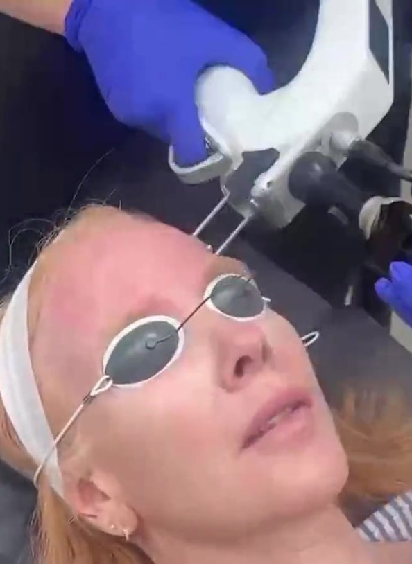 CO2 skin resurfacing with the YouLaser at Seamless Health