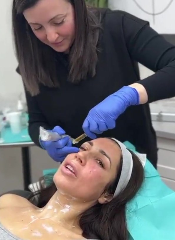 PRP facial rejuvenation treatment at Seamless Health