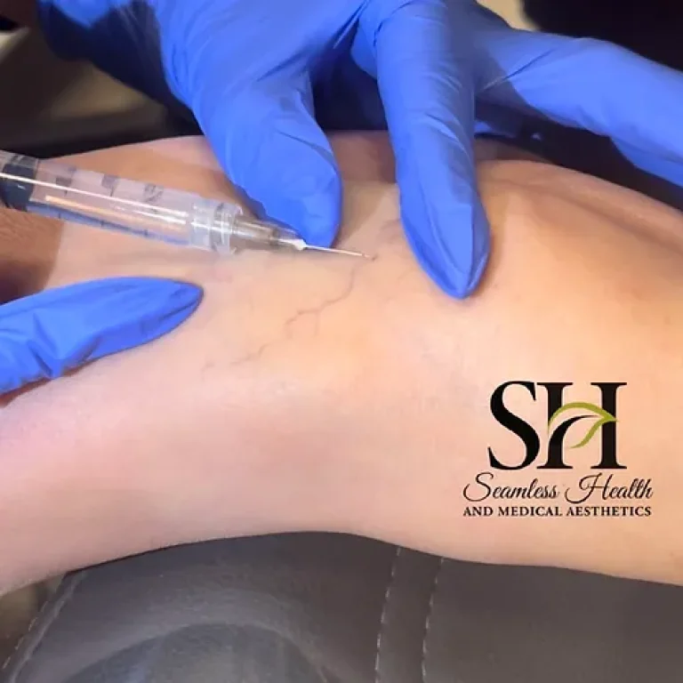 sclerotherapy-training-1